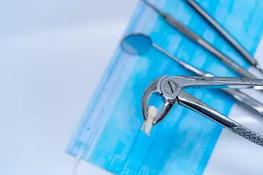 Extractie dentara